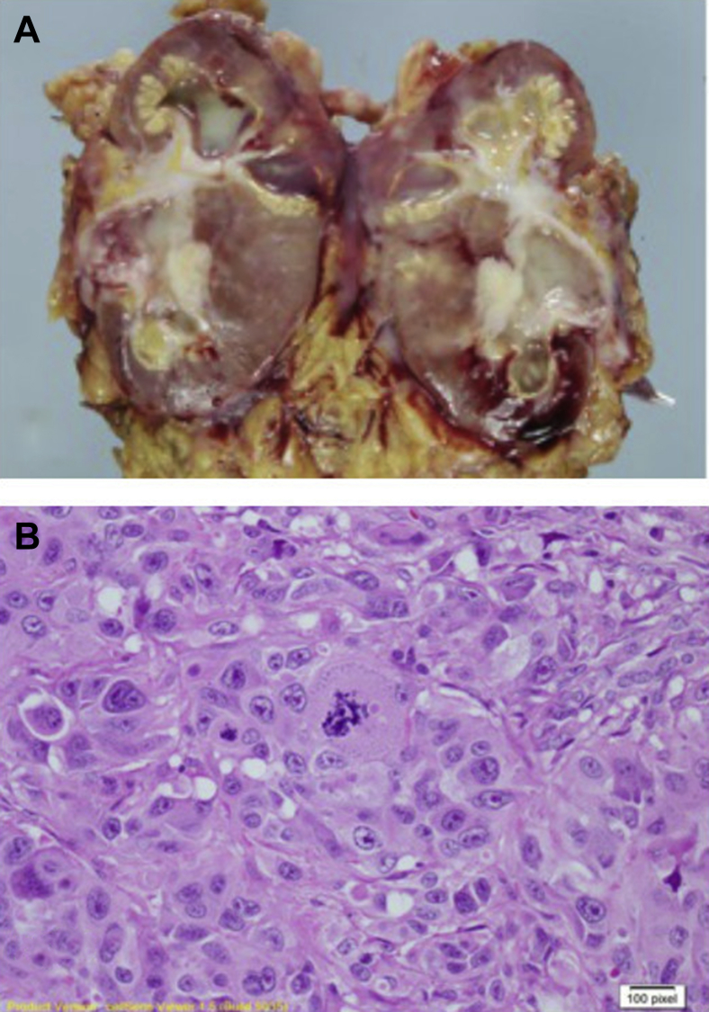 Fig. 2