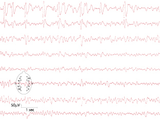 graphic file with name 978-3-662-57295-5_7_Fig1_HTML.jpg