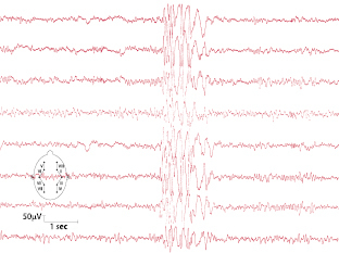 graphic file with name 978-3-662-57295-5_7_Fig3_HTML.jpg