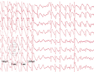 graphic file with name 978-3-662-57295-5_7_Fig5_HTML.jpg