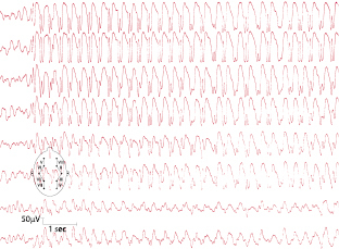 graphic file with name 978-3-662-57295-5_7_Fig2_HTML.jpg