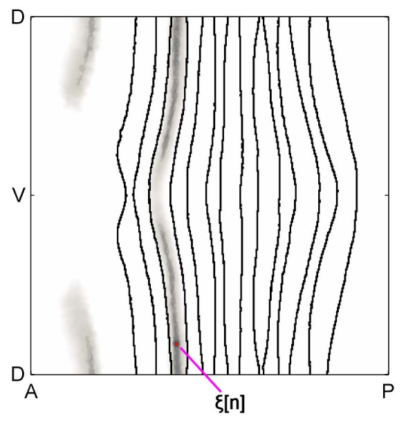 Figure 11