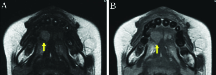 [Table/Fig-3a,b]: