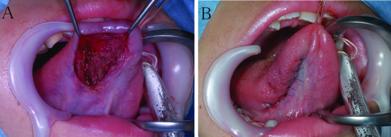 [Table/Fig-4a,b]: