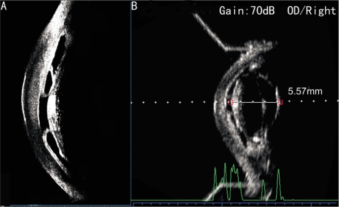 Figure 6