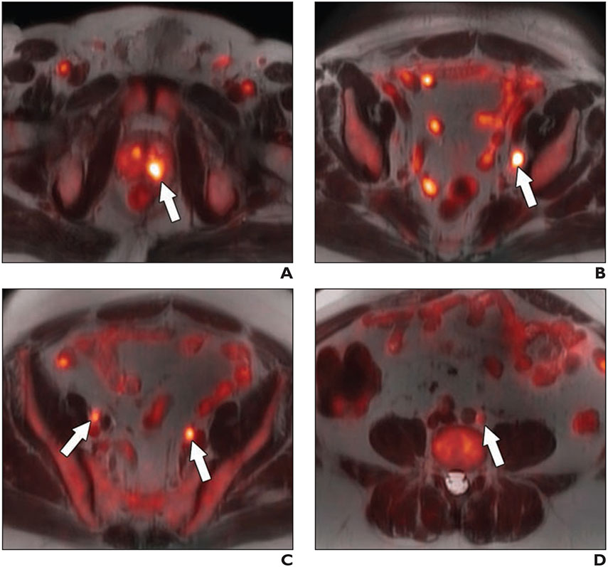 Fig. 3—