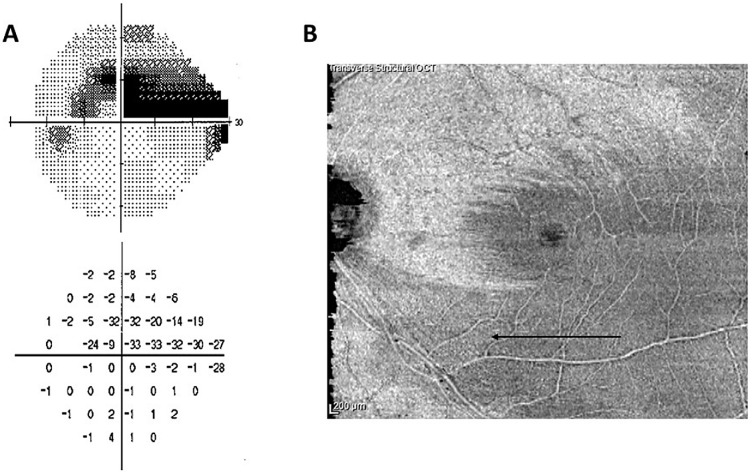 Figure 9.