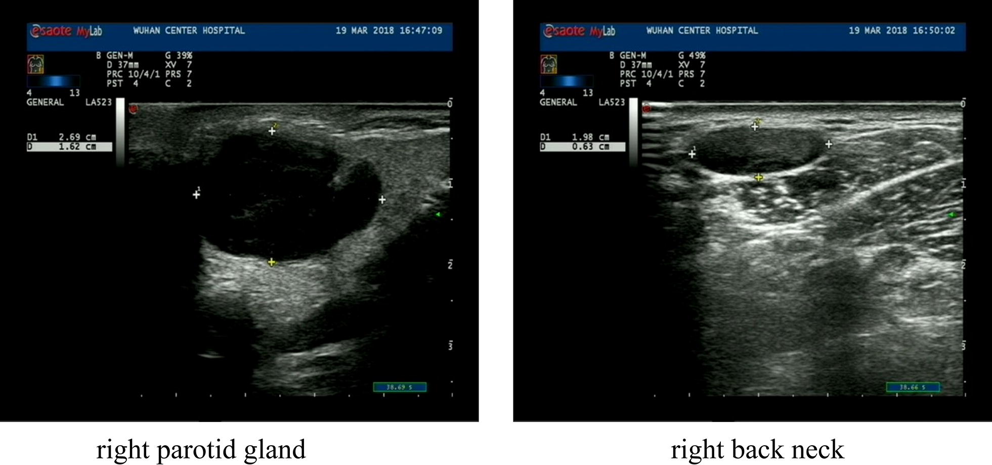 Fig. 2