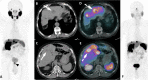 Fig. 21