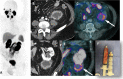 Fig. 13
