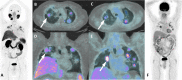 Fig. 25