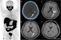 Fig. 23