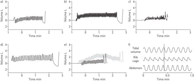 FIGURE 1