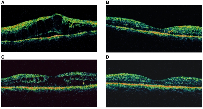 Fig. 3