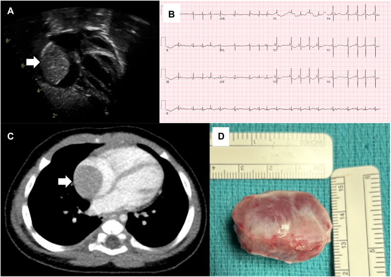 Figure 1