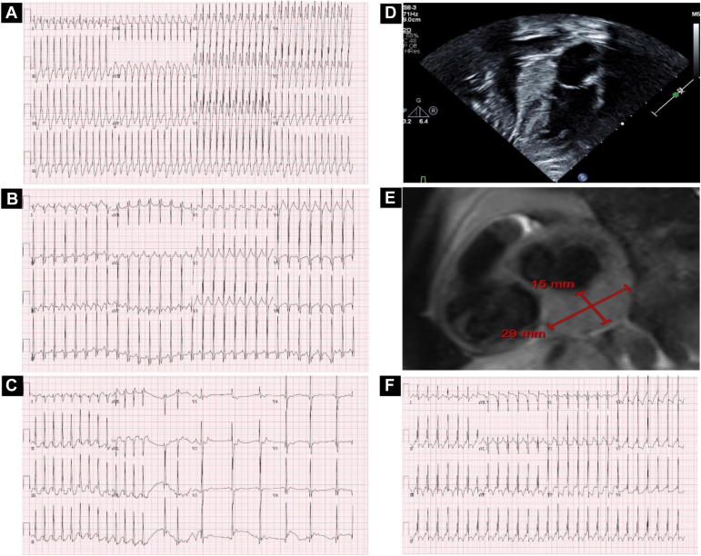 Figure 2