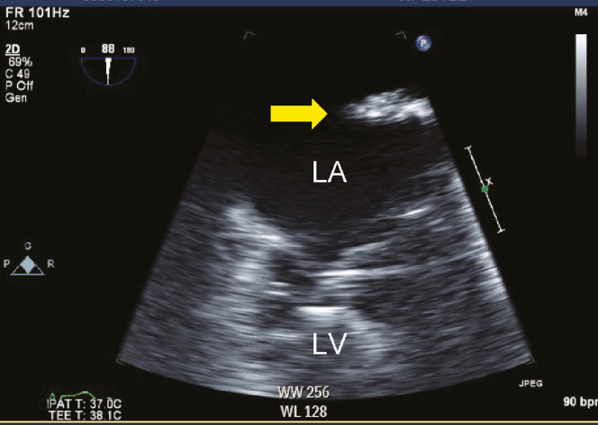 Figure 2