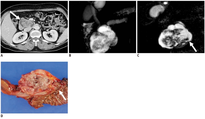 Fig. 12