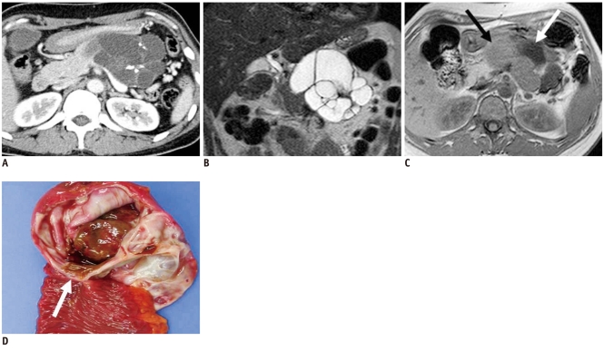 Fig. 11