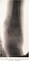 346-2