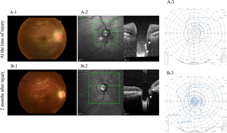 Fig. 4