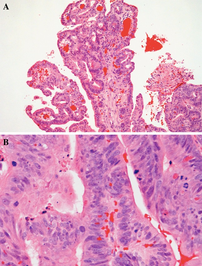 Fig. 2