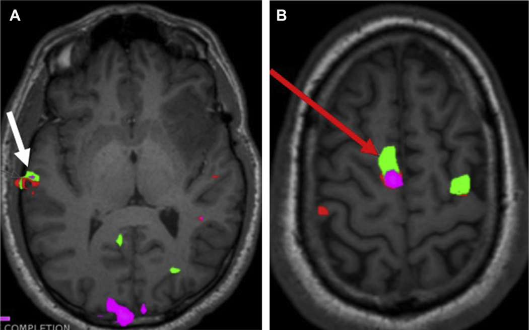 Fig. 4.