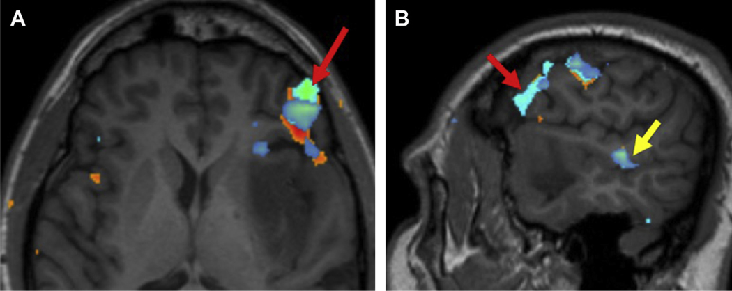 Fig. 6.