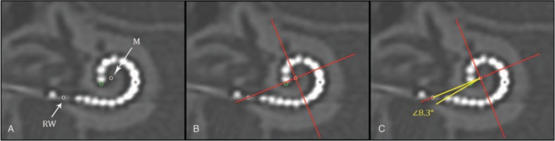 FIG. 1