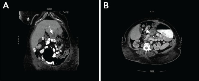 FIGURE 1