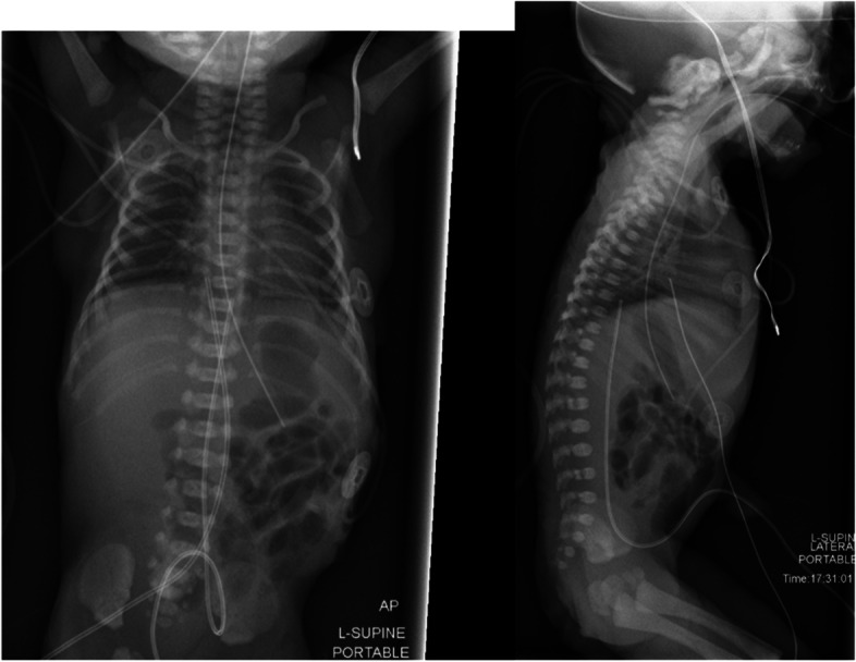 Fig. 1