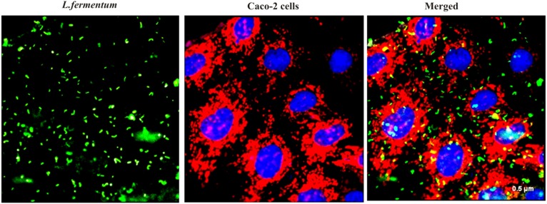 FIGURE 2