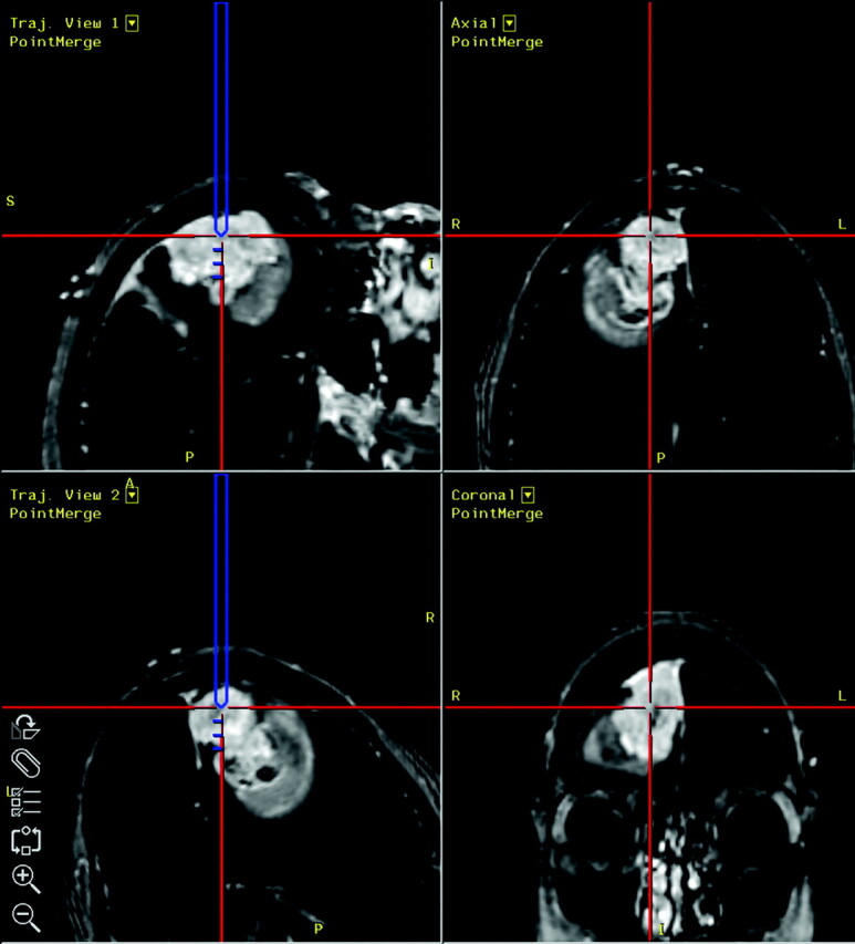 Fig 2.