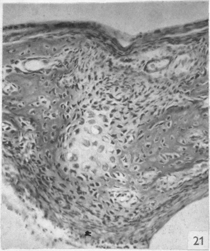 Fig. 21