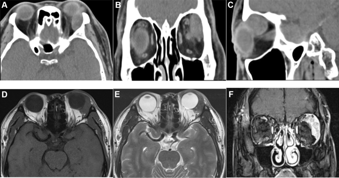 Fig. 1