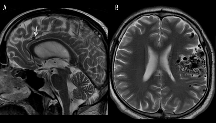 Figure 16