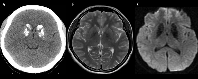 Figure 14