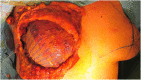 Fig. 12