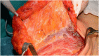 Fig. 10