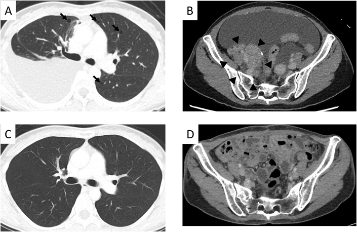 Fig. 2