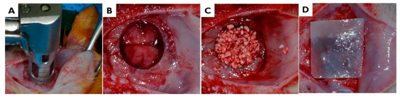 Figure 15