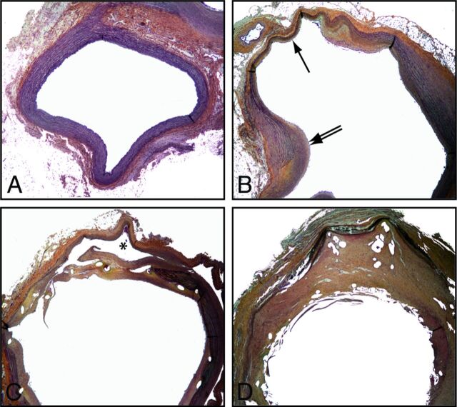 Fig 4.