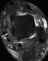 Figure 7d