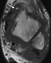 Figure 11d