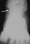 Figure 11a