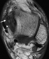 Figure 10c