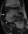 Figure 6b