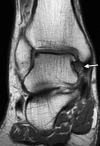 Figure 12a