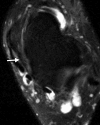 Figure 6c