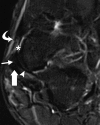 Figure 2c